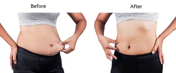 depositphotos 89773324 stock photo women body fat belly between NujumGCC